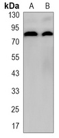 CD71 Rabbit Monoclonal Antibody