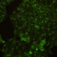 CD71 Rabbit Monoclonal Antibody