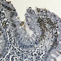 Topoisomerase 1 Rabbit Monoclonal Antibody