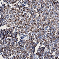 TOM20 Rabbit Monoclonal Antibody