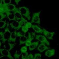 TOM20 Rabbit Monoclonal Antibody