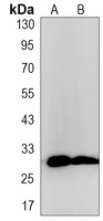 TMEM192 Rabbit Monoclonal Antibody