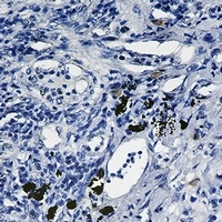 SMAD2 Rabbit Monoclonal Antibody