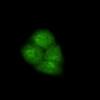 SMAD2 Rabbit Monoclonal Antibody
