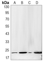 RKIP Rabbit Monoclonal Antibody