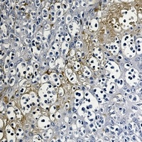 RKIP Rabbit Monoclonal Antibody