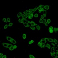 UPF1 Rabbit Monoclonal Antibody