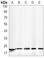 Presenilin 1 Rabbit Monoclonal Antibody