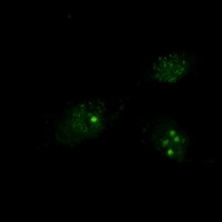 Presenilin 1 Rabbit Monoclonal Antibody