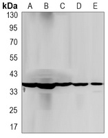PP1 beta Rabbit Monoclonal Antibody