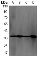 NEK7 Rabbit Monoclonal Antibody