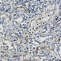 Moesin Rabbit Monoclonal Antibody