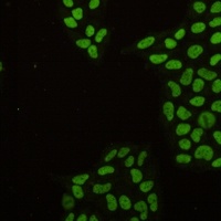 MCM2 Rabbit Monoclonal Antibody