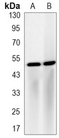 LXR alpha Rabbit Monoclonal Antibody