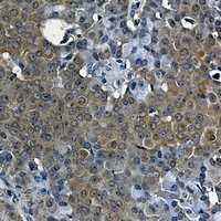 LXR alpha Rabbit Monoclonal Antibody