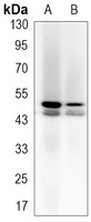 JNK1 Rabbit Monoclonal Antibody