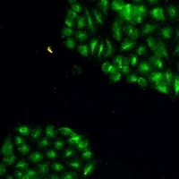 JNK1 Rabbit Monoclonal Antibody