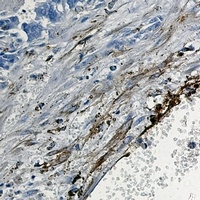 CD49e Rabbit Monoclonal Antibody