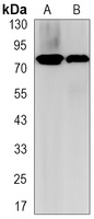 HSF1 Rabbit Monoclonal Antibody