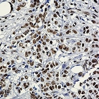 HSF1 Rabbit Monoclonal Antibody