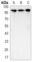 Hexokinase 2 Rabbit Monoclonal Antibody
