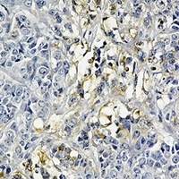 Hexokinase 2 Rabbit Monoclonal Antibody