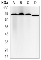 Glucocorticoid Receptor Rabbit Monoclonal Antibody
