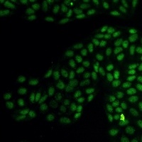 Glucocorticoid Receptor Rabbit Monoclonal Antibody