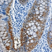 Galectin 3 Rabbit Monoclonal Antibody