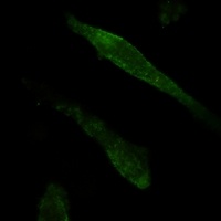 Galectin 3 Rabbit Monoclonal Antibody