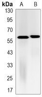 FTO Rabbit Monoclonal Antibody