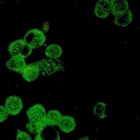 Estrogen Receptor alpha Rabbit Monoclonal Antibody