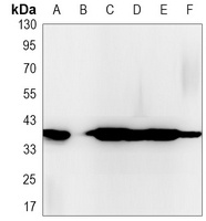 CD326 Rabbit Monoclonal Antibody
