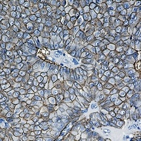 CD326 Rabbit Monoclonal Antibody