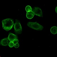 CD326 Rabbit Monoclonal Antibody