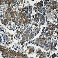 4EBP1 Rabbit Monoclonal Antibody