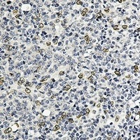 E2F1 Rabbit Monoclonal Antibody