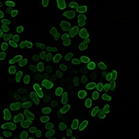 E2F1 Rabbit Monoclonal Antibody