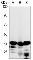 Cathepsin B Antibody
