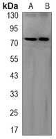 ALPL Rabbit Monoclonal Antibody