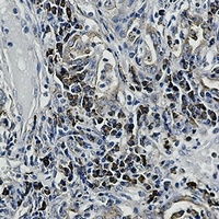 ALPL Rabbit Monoclonal Antibody