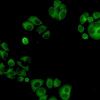 ALPL Rabbit Monoclonal Antibody