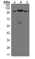 ALIX Rabbit Monoclonal Antibody