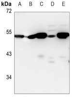 ADSS Rabbit Monoclonal Antibody