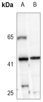 ACAT1 Rabbit Monoclonal Antibody