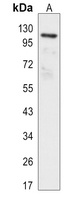 Focal Adhesion Kinase (Phospho-Y397) Rabbit Monoclonal Antibody