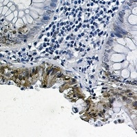 SMAD2 (Phospho-S255) Rabbit Monoclonal Antibody