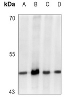 GSK3 beta (Phospho-S9) Rabbit Monoclonal Antibody