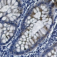 GSK3 beta (Phospho-S9) Rabbit Monoclonal Antibody