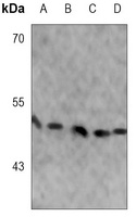 SMAD3 (Phospho-S423/425) Rabbit Monoclonal Antibody